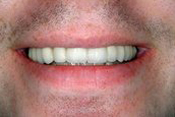 Andrew S. Beyer DMD