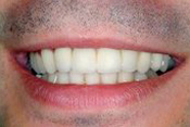 Andrew S. Beyer DMD
