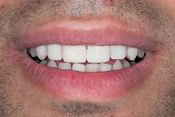 Andrew S. Beyer DMD