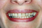 Andrew S. Beyer DMD
