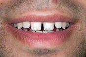 Andrew S. Beyer DMD